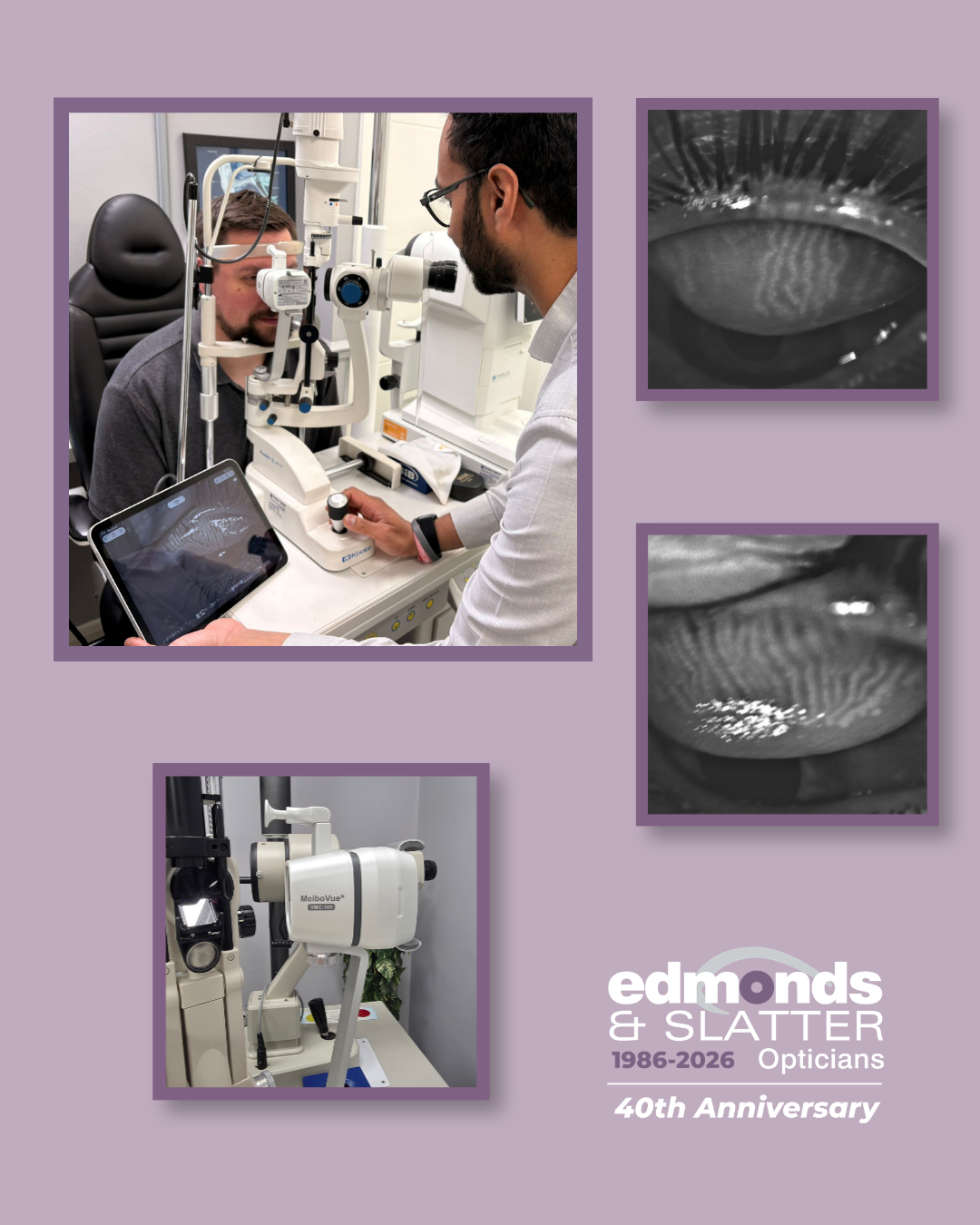 Edmonds &amp; Slatter Strengthens Dry Eye Care with New Imaging Technology 